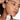 Niacinamide 20% Serum